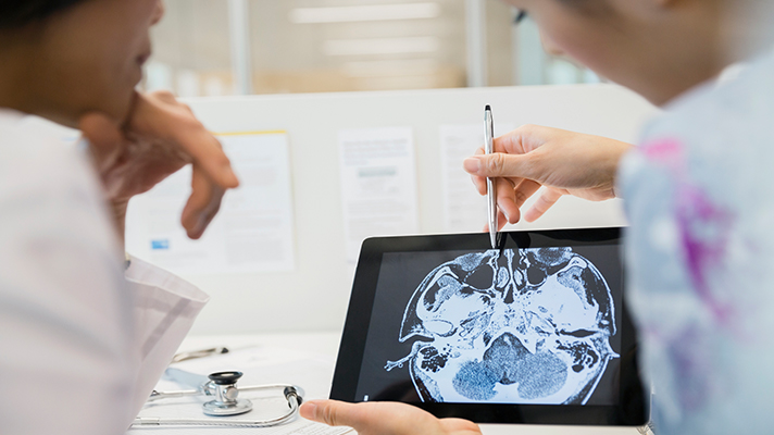 Doctors looking at a brain scan