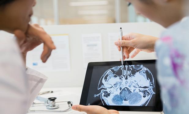 Doctors looking at a brain scan